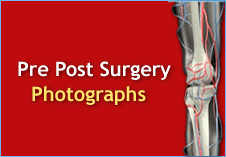 Pre-post Surgery Photographs Pre-post Surgery Photographs